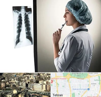 دکتر سرطان ریه در مرزداران 