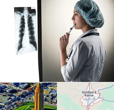دکتر سرطان ریه در گنبد کاووس
