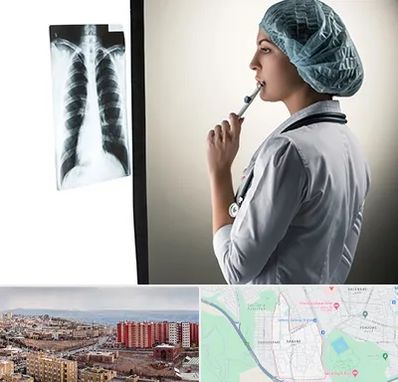 دکتر سرطان ریه در سهند تبریز