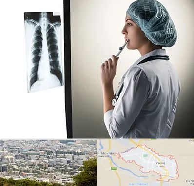دکتر سرطان ریه در یاسوج