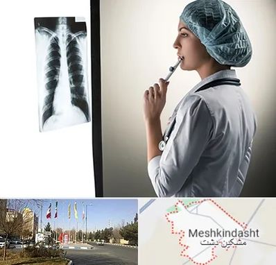 دکتر سرطان ریه در مشکین دشت