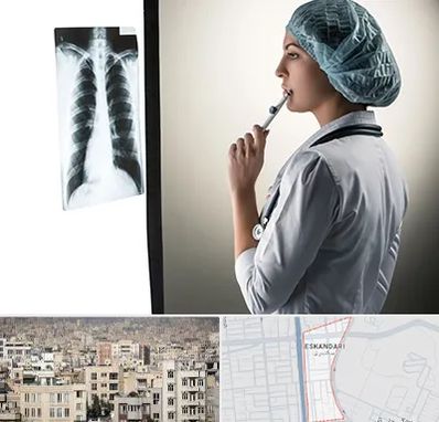 دکتر سرطان ریه در اسکندری