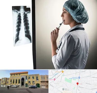 دکتر سرطان ریه در زنبیل آباد قم