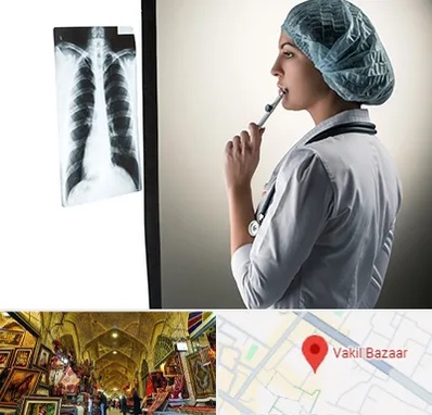 دکتر سرطان ریه در بازار وکیل شیراز