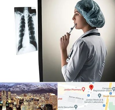دکتر سرطان ریه در جردن 