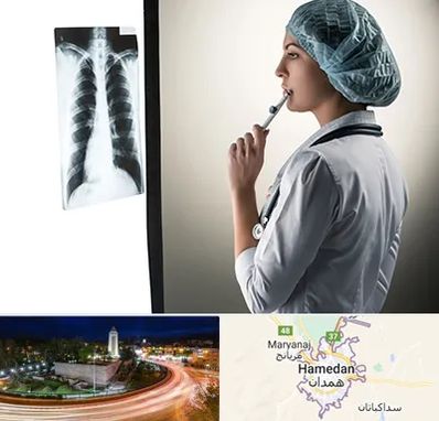 دکتر سرطان ریه در همدان