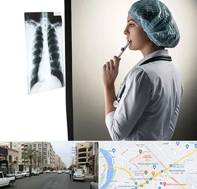 دکتر سرطان ریه در زیتون کارمندی اهواز 