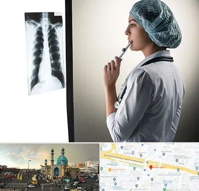 دکتر سرطان ریه در رسالت 