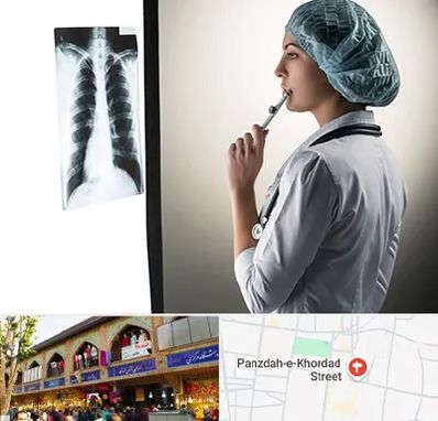 دکتر سرطان ریه در 15 خرداد