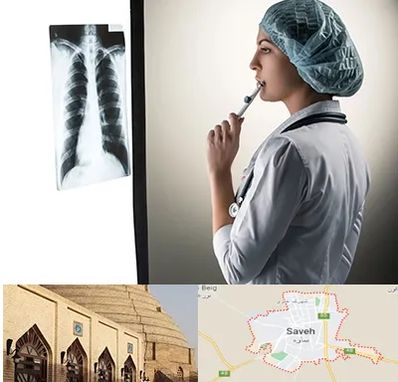 دکتر سرطان ریه در ساوه