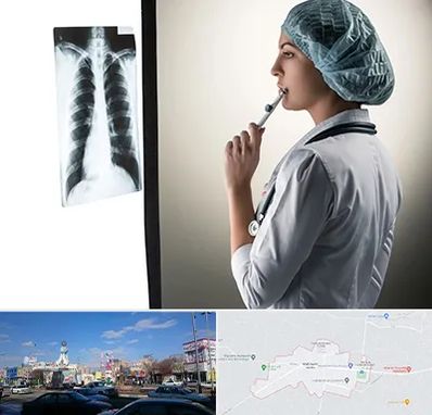 دکتر سرطان ریه در ماهدشت کرج 