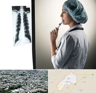 دکتر سرطان ریه در شاهرود