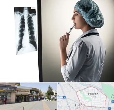 دکتر سرطان ریه در پرواز تبریز