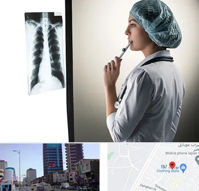 دکتر سرطان ریه در چهارراه طالقانی کرج 