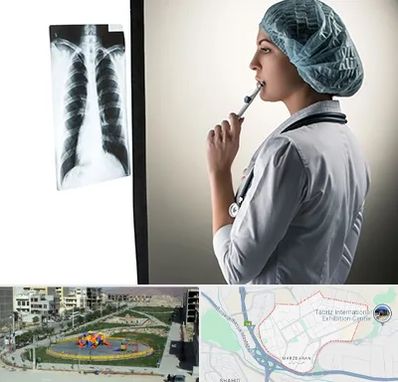 دکتر سرطان ریه در مرزداران تبریز