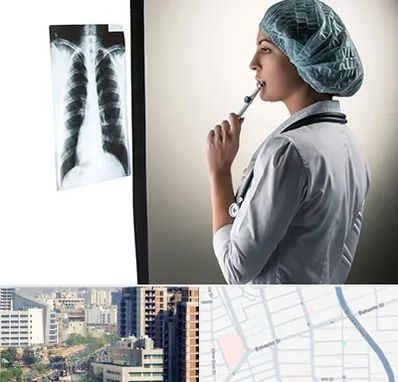 دکتر سرطان ریه در خیابان بهشتی