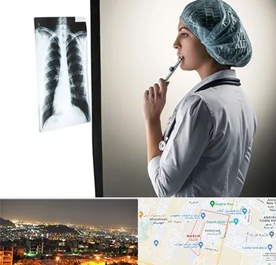 دکتر سرطان ریه در مارلیک کرج 