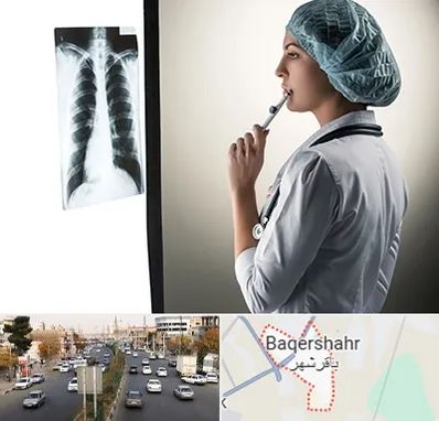 دکتر سرطان ریه در باقرشهر