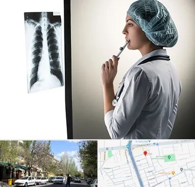 دکتر سرطان ریه در کوی فیروز تبریز