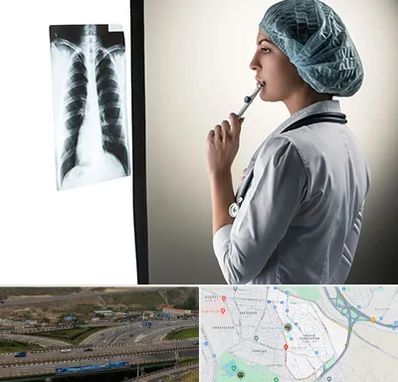 دکتر سرطان ریه در یاغچیان تبریز