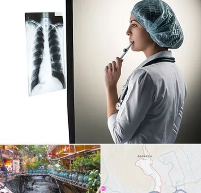 دکتر سرطان ریه در درکه