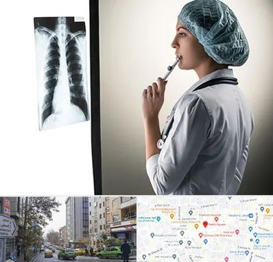 دکتر سرطان ریه در فاطمی 