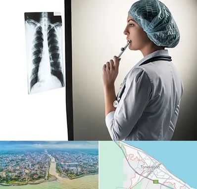 دکتر سرطان ریه در تنکابن
