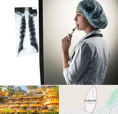 دکتر سرطان ریه در دربند