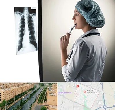 دکتر سرطان ریه در فاز سه اندیشه