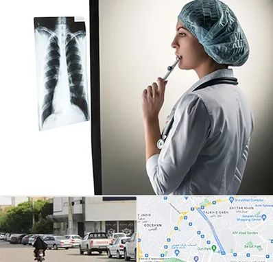 دکتر سرطان ریه در قدوسی شرقی شیراز 