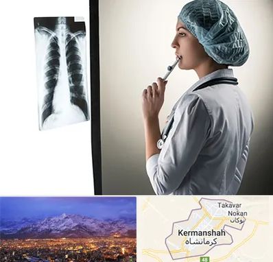 دکتر سرطان ریه در کرمانشاه