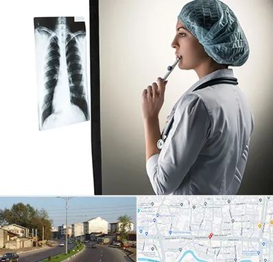 دکتر سرطان ریه در ضیابری رشت 