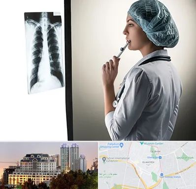 دکتر سرطان ریه در فرشته 