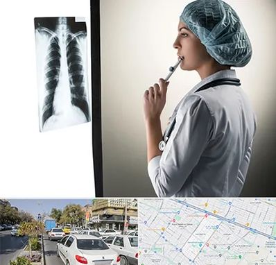 دکتر سرطان ریه در مفتح مشهد 