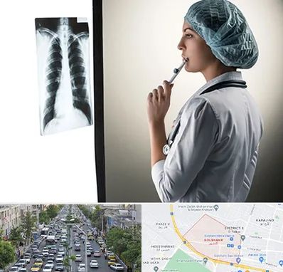 دکتر سرطان ریه در گلشهر کرج 