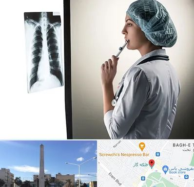 دکتر سرطان ریه در فلکه گاز شیراز 