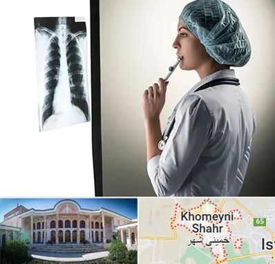 دکتر سرطان ریه در خمینی شهر
