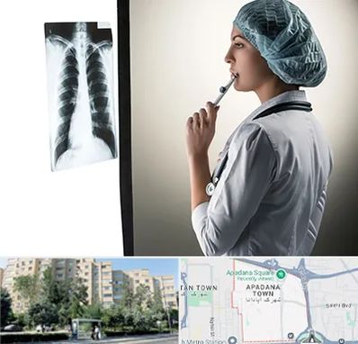 دکتر سرطان ریه در آپادانا
