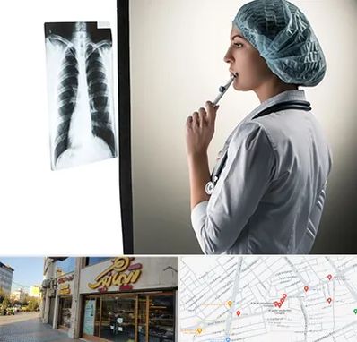 دکتر سرطان ریه در عطاران قم