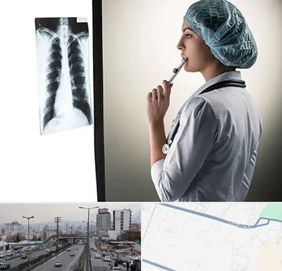 دکتر سرطان ریه در بلوار ارتش