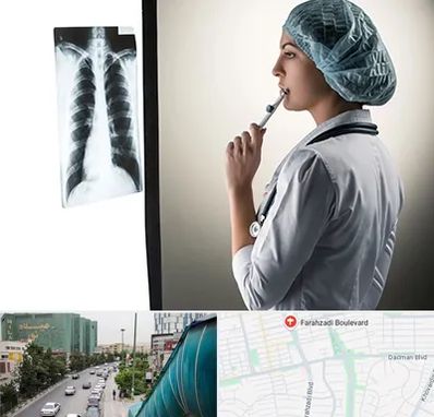 دکتر سرطان ریه در بلوار فرحزادی