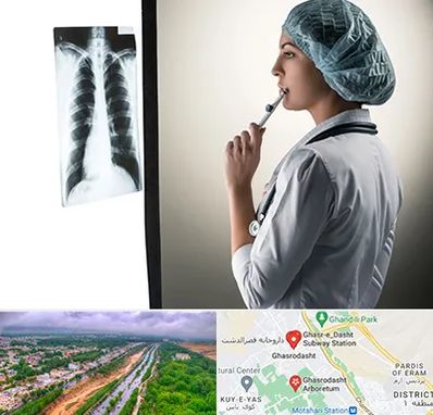 دکتر سرطان ریه در قصرالدشت شیراز 