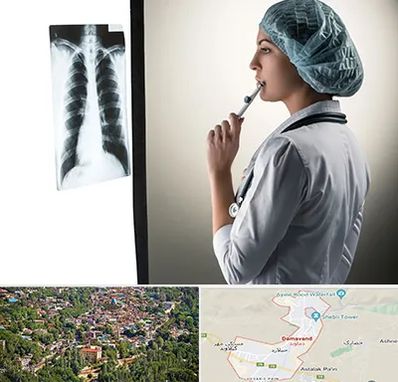 دکتر سرطان ریه در دماوند