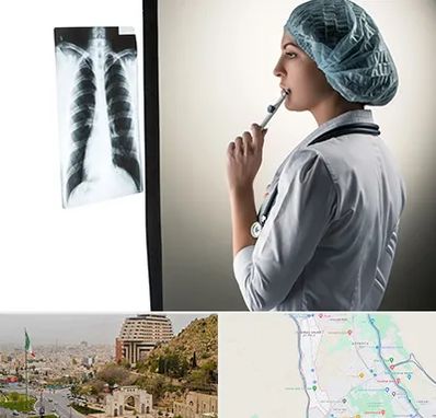 دکتر سرطان ریه در فرهنگ شهر شیراز 