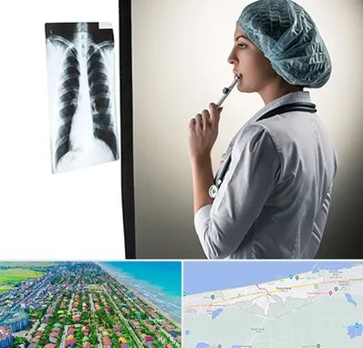 دکتر سرطان ریه در فریدونکنار