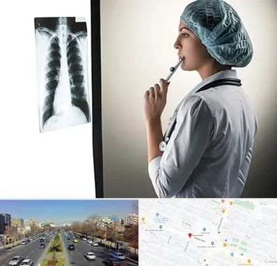 دکتر سرطان ریه در بلوار معلم مشهد 