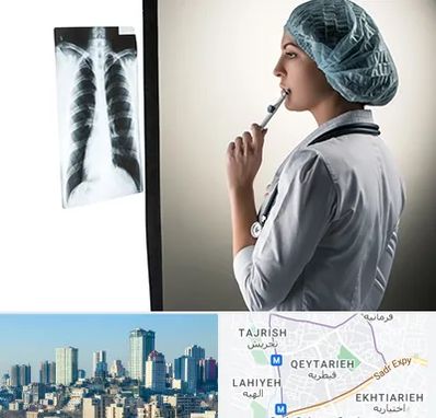دکتر سرطان ریه در قیطریه 