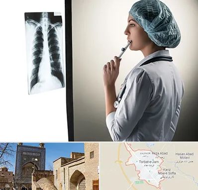 دکتر سرطان ریه در تربت جام