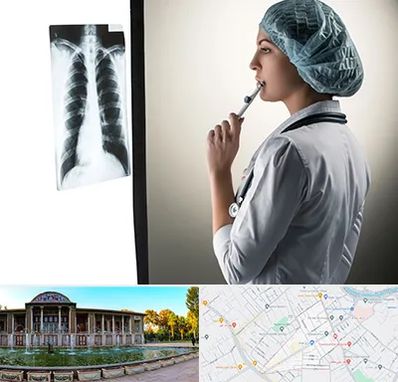 دکتر سرطان ریه در عفیف آباد شیراز 