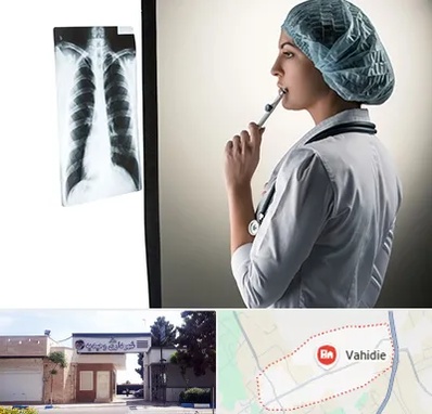 دکتر سرطان ریه در وحیدیه شهریار